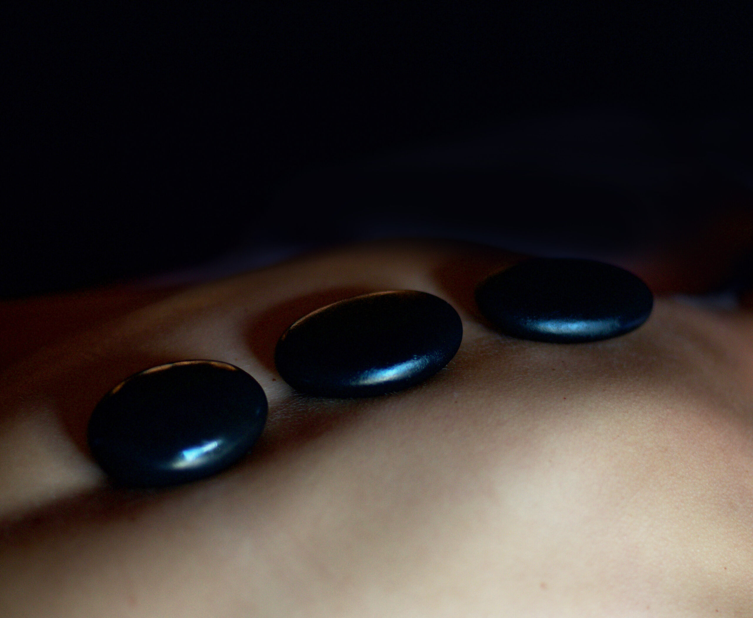 Three smooth black massage stones placed on a person's back against a dark background.